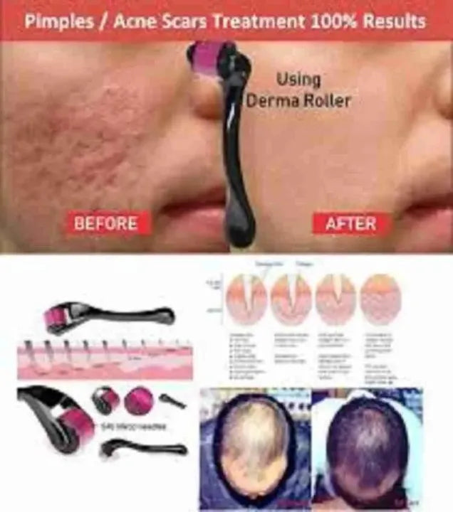 💆✨ Professional Derma Roller 0.5mm 🪒 540 Titanium Needles 🌟 | Beauty Care Tool for Smooth & Fresh Skin 💖