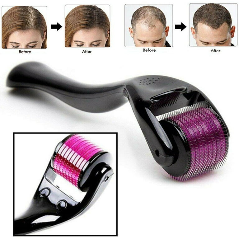 💆✨ Professional Derma Roller 0.5mm 🪒 540 Titanium Needles 🌟 | Beauty Care Tool for Smooth & Fresh Skin 💖