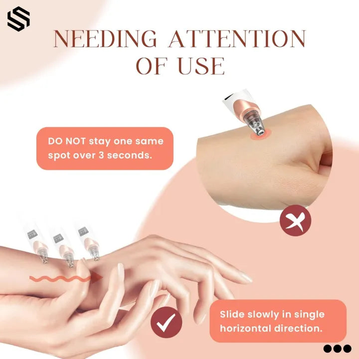 ✨💆 Derma Suction Pore Cleaner 🖤 Powerful Vacuum Blackhead Remover 🌸 | Removes Dirt & Oil for Smooth, Fresh Skin ✨ | Cell Operated 🔋